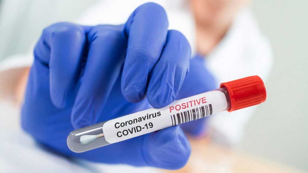 CovidTest